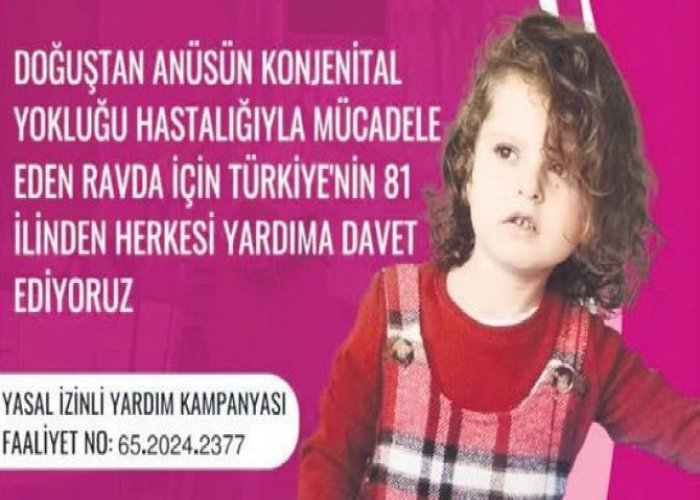 Hakkarili Minik Ravda, İngiltere'deki Tedavisi İçin Yardım Bekliyor